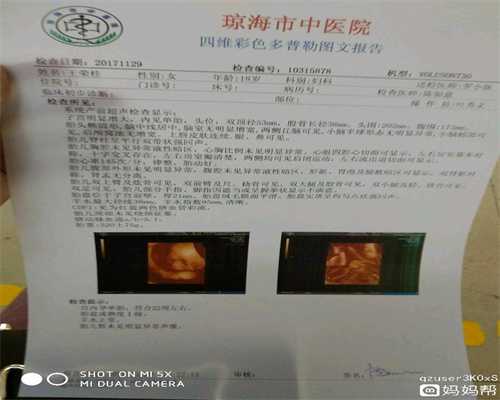 北京代孕中心,分享我的备孕经验，快速怀孕生娃