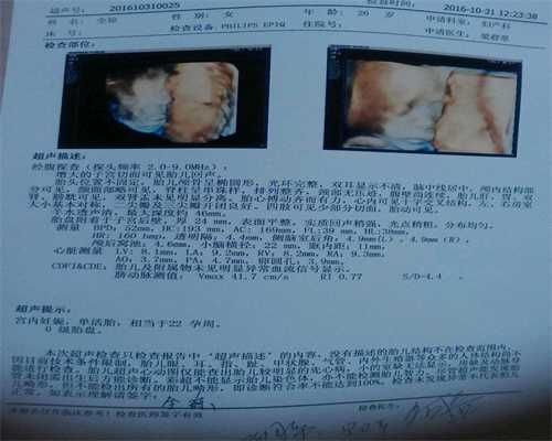 北京供卵过程-怀孕了肚子上有黑线是儿子还是女