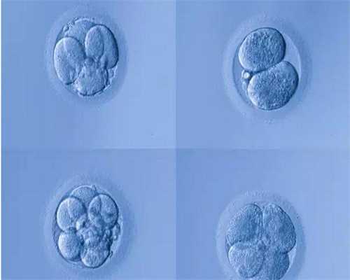 北京代孕费用_双胞胎与单胎分娩有哪些不同 双胞