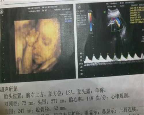 北京代孕包儿子_hcg针会影响排卵试纸吗