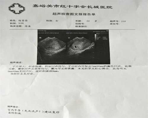 北京代孕包性别_孕期30周做b超胎儿双肾集合分离
