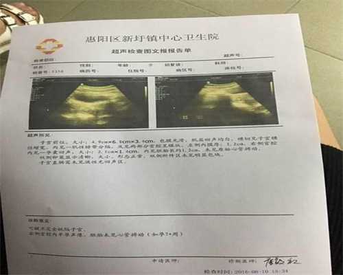 北京代孕多少钱_锻炼子宫卵巢的运动