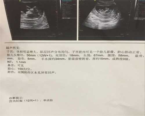 北京代孕包男孩_上海第一例试管婴儿在哪家医院