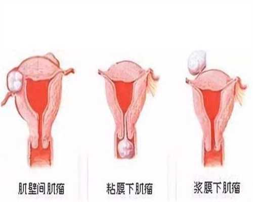 北京人工代孕_北京代妈自尽新闻_北京试管婴儿取卵代孕