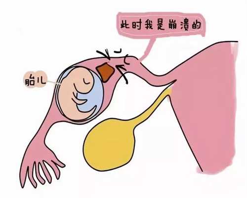 北京供卵代孕`权威北京代孕零首付`北京代怀孕招捐卵女生