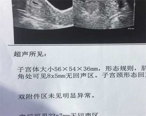 北京代孕方法~北京代孕公司价格~3代北京试管代孕的大概费用
