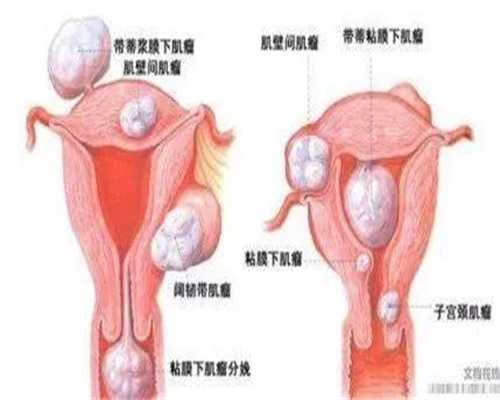 北京代孕集团~北京自然代孕公司~北京代孕一次需要多少钱