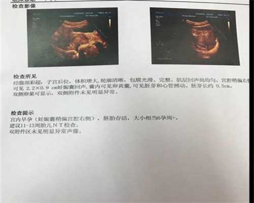 北京代妈价格-北京供卵中心费用-刚怀孕应该注意些什么