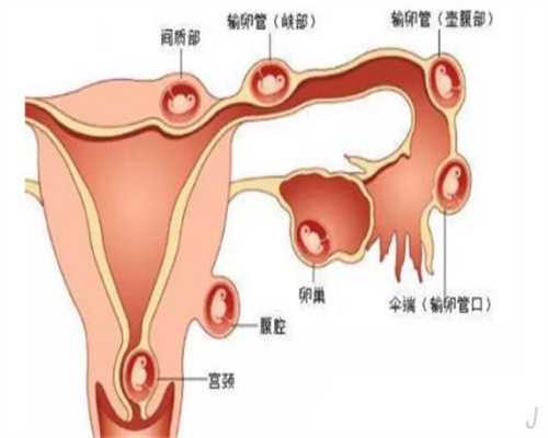 北京靠谱代孕~怎么北京代孕合法~孕妇右肾积水是怎么回事