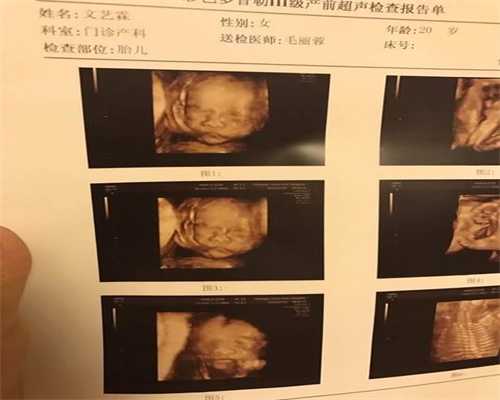 北京代孕价格,北京代孕好做吗,北京个人找正规代孕妈妈