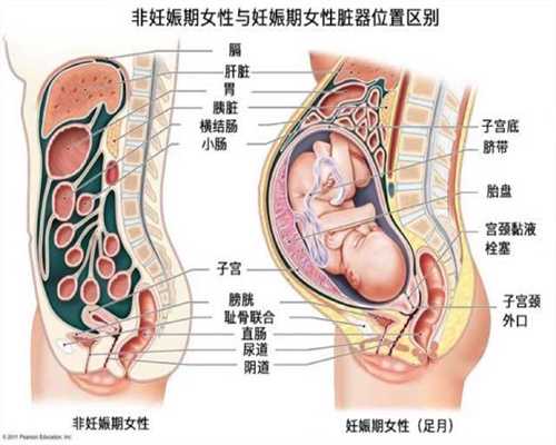 北京代孕在线咨询_深圳正规代怀孕价格_找捐卵代怀孕联系方式