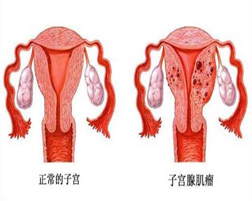 专业的助孕包成功-北京代孕大概要花多少钱_北京哪家试管婴儿医院好  做试管