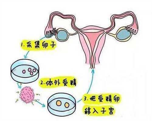 北京有供卵的生殖中心-代孕成功率真的很高吗_北京方舟皮肤病医院检查多少钱