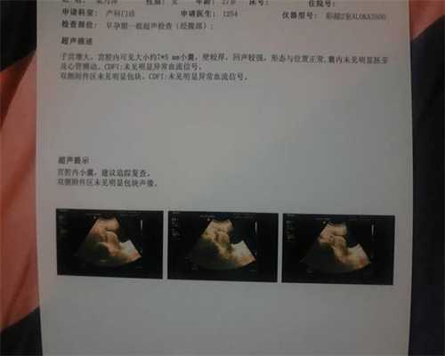 北京公立医院供卵要求-供卵价格一般多少_北京市顺义区中医医院试管婴儿具体