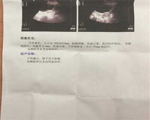 试管婴儿代孕是怎么回事-北京代孕成功率有多少_北京三院做试管婴儿多少钱？