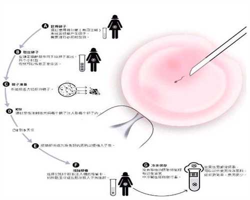 助孕价格-北京有人找代孕的吗_北京哪里做三代试管最好？怎么选择？  ​