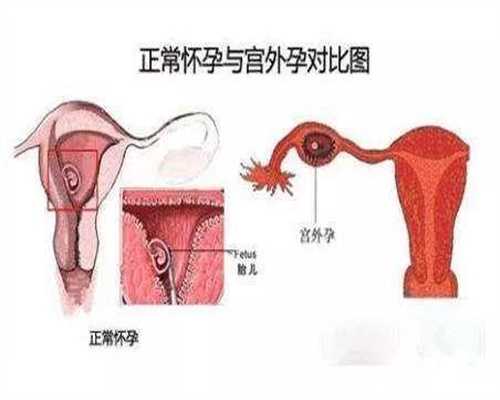 北京公立医院供卵要求-代孕机构代生孩子多少钱_2021最新北京十强试管婴儿医院